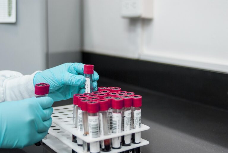 Profissional de laboratório com luvas analisando amostras representando o exame toxicológico de larga janela de detecção nos concursos policiais PM SP e GCM SP