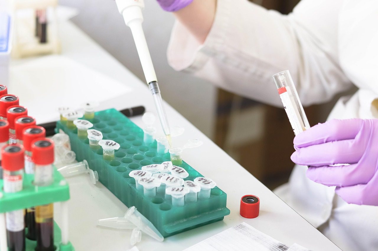 Coleta de amostra de cabelo para exame toxicológico de larga janela no concurso PM